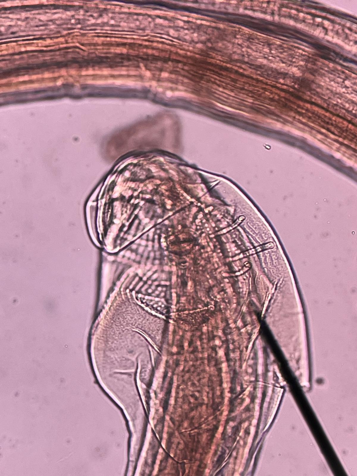 Nematode under light microscopy