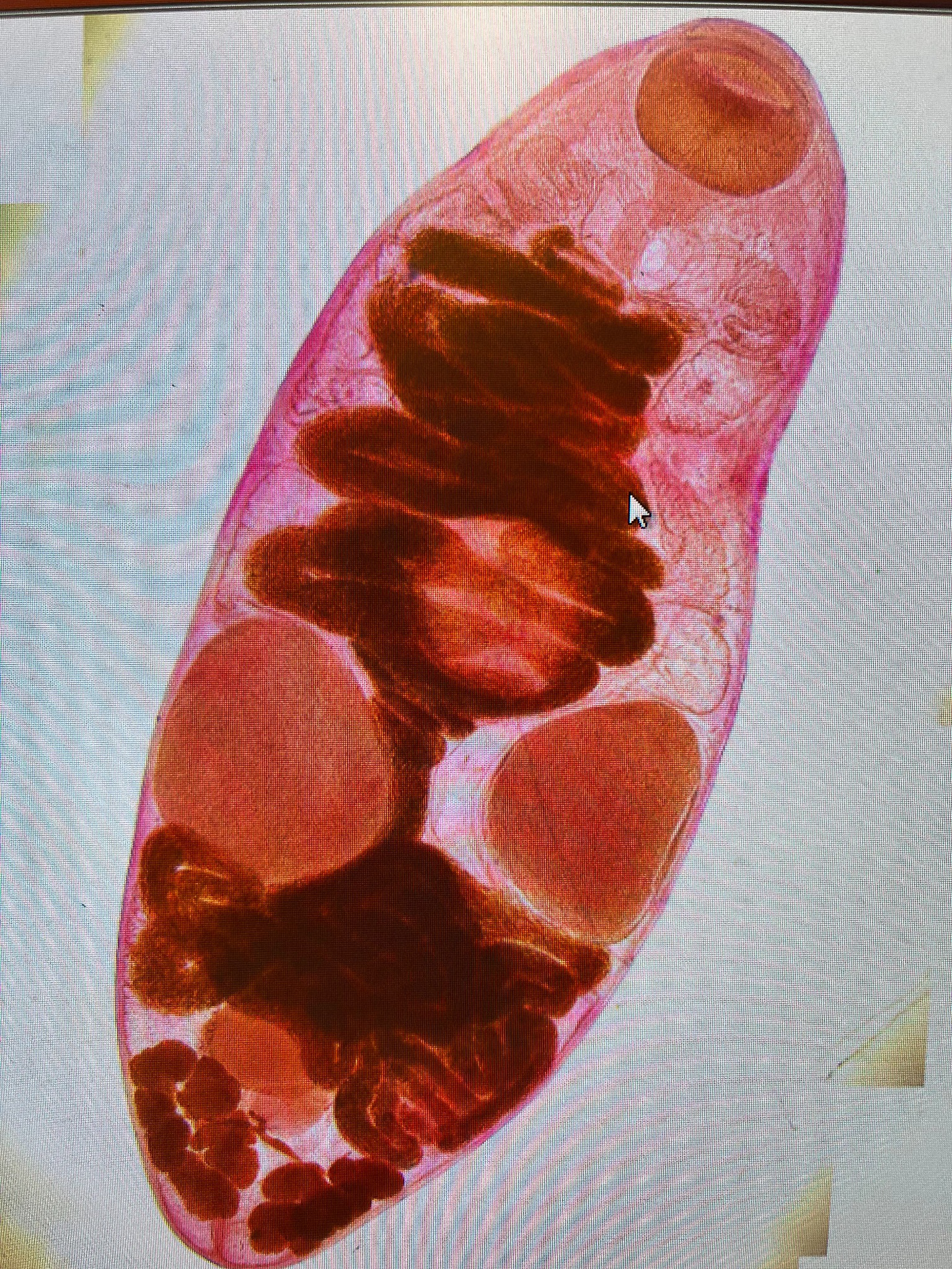 Whole trematode specimen cleared with ethanol and stained with paracarmine, viewed by brightfield microscopy at 10× magnification