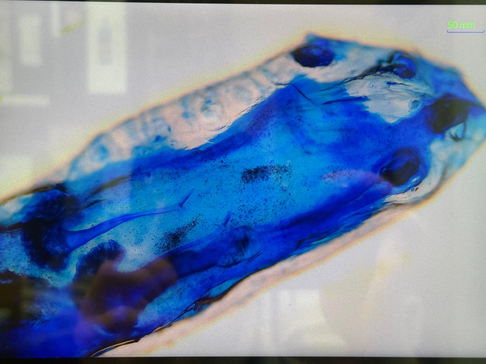 Blue-stained parasite specimen under microscopy