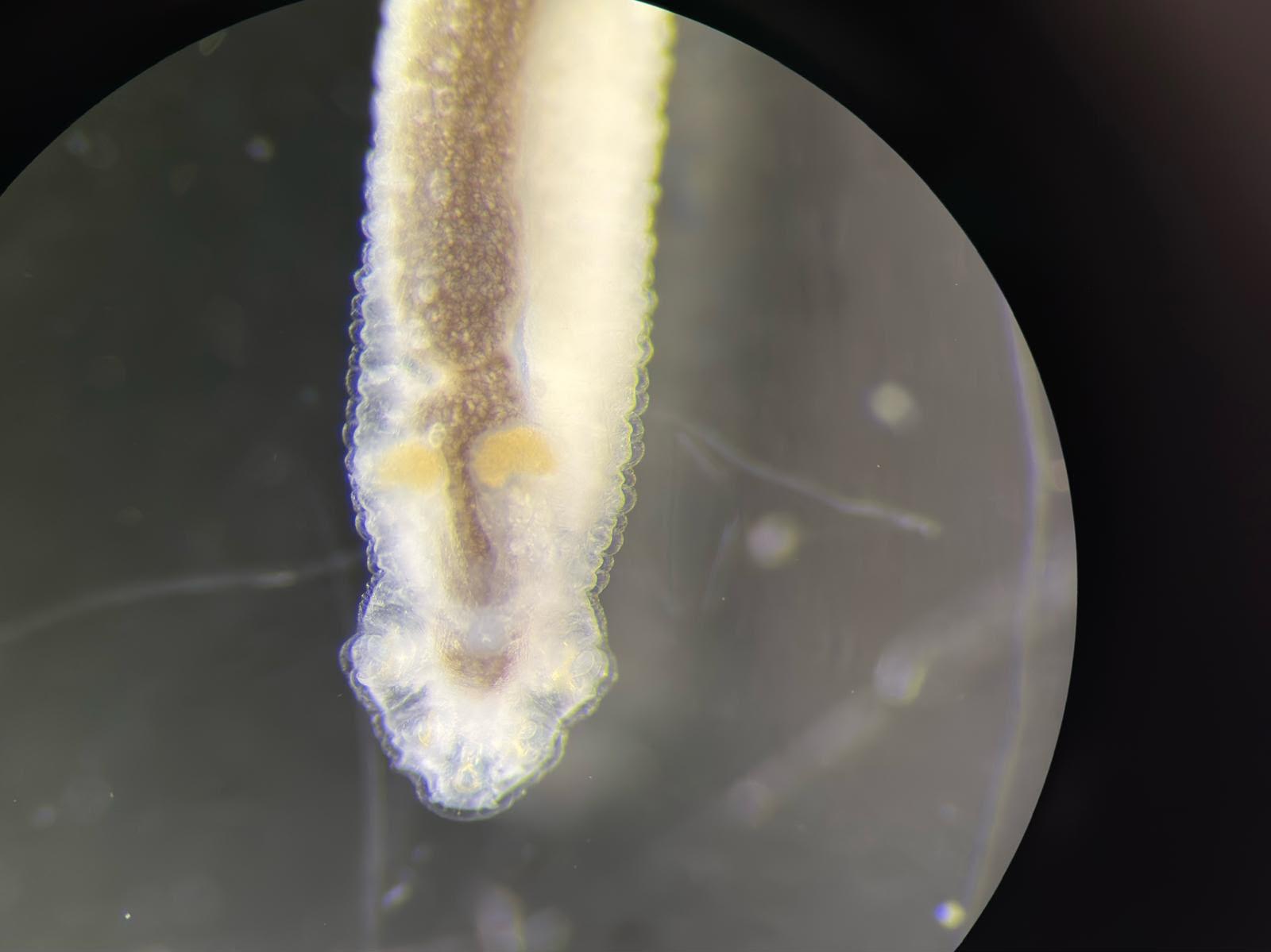 Pentastome anterior — brightfield