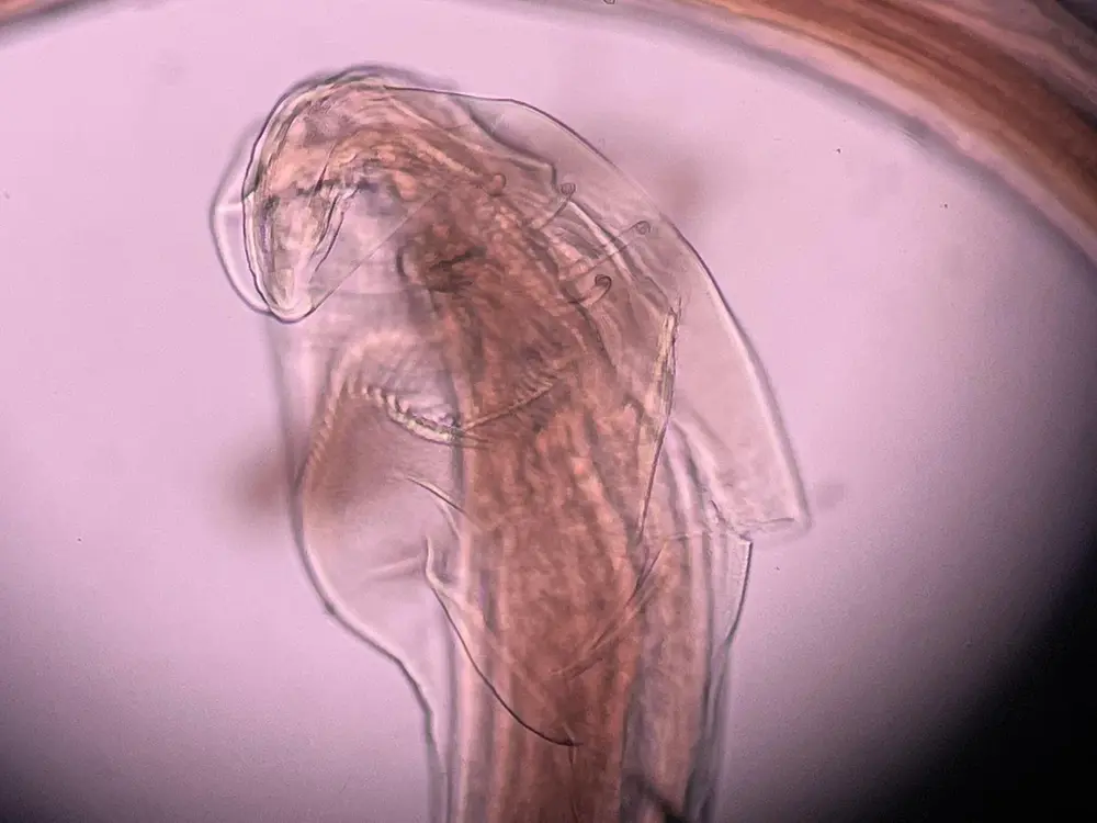 Diagnostic parasite morphology under light microscopy