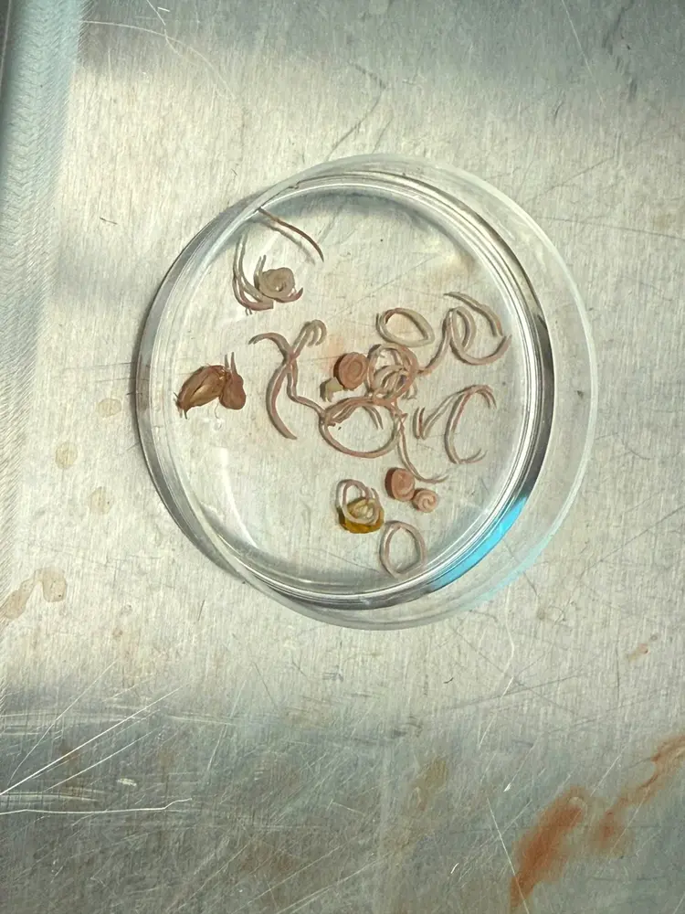 Parasite specimens in a collection dish
