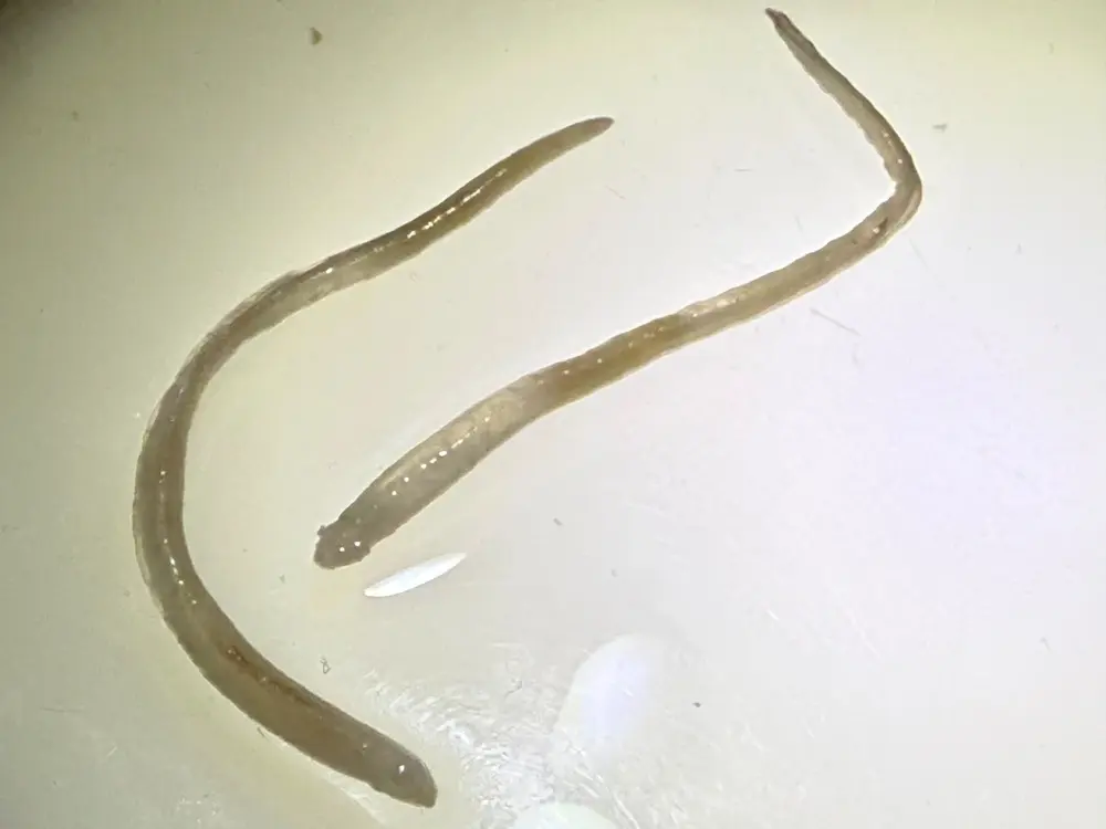 Whole parasite specimens
