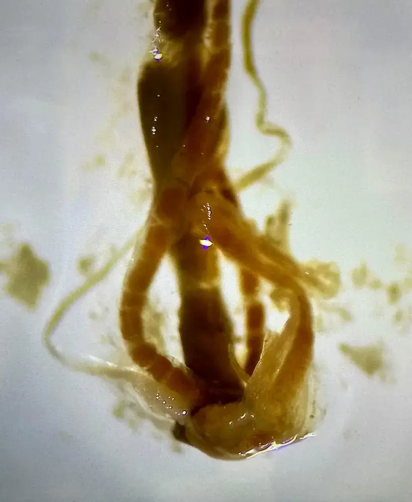 Parasite specimen detail
