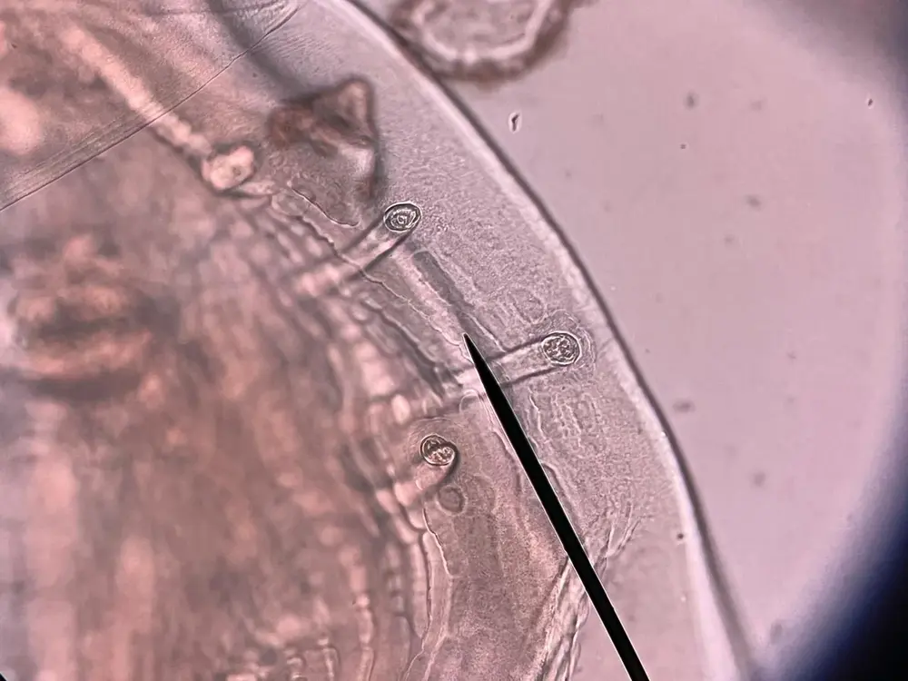 Diagnostic parasite structure under microscopy