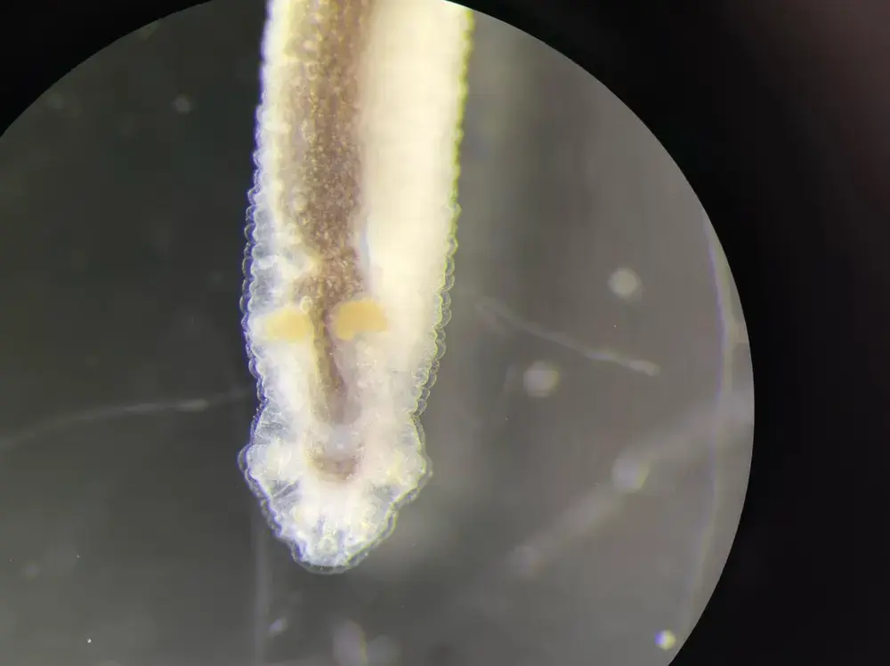 Pentastome anterior – brightfield
