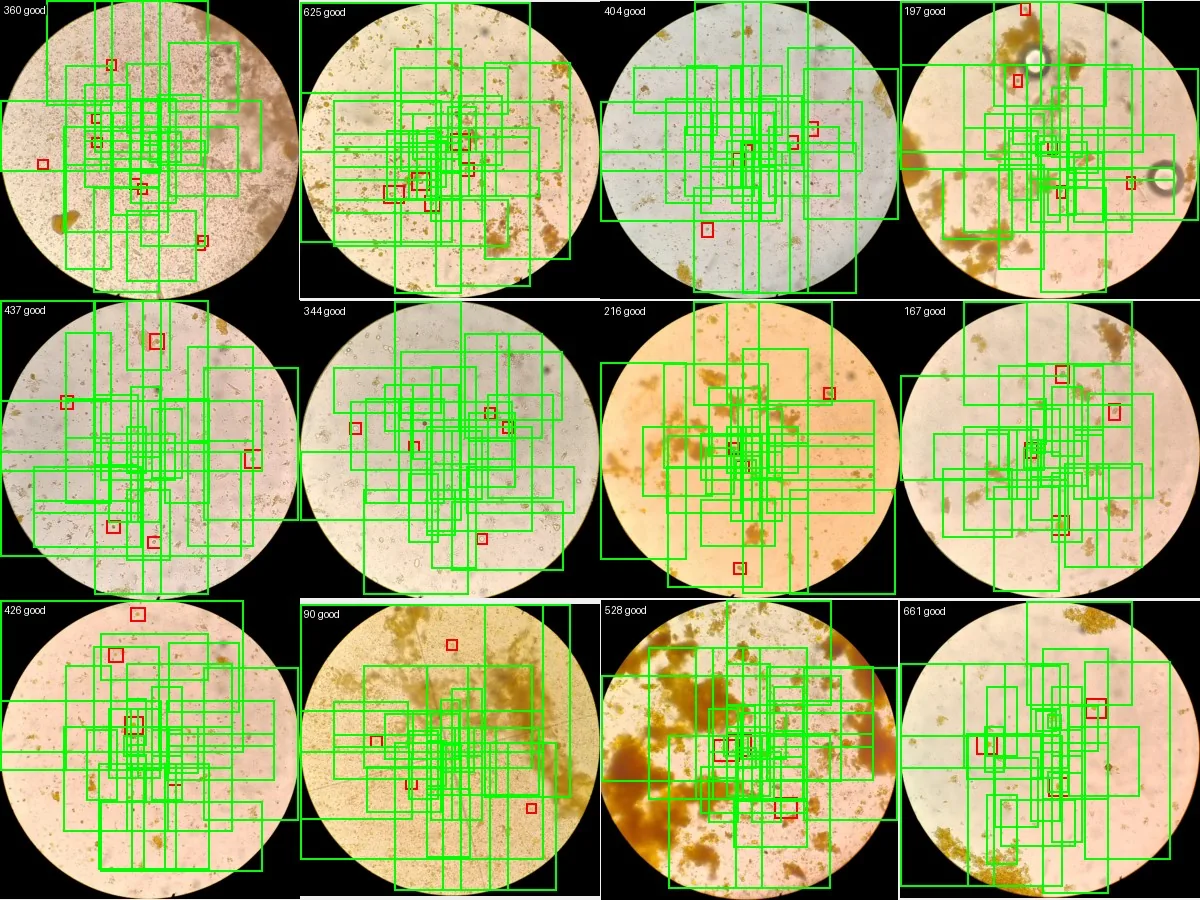 Contact sheet of microscope fields with candidate boxes
