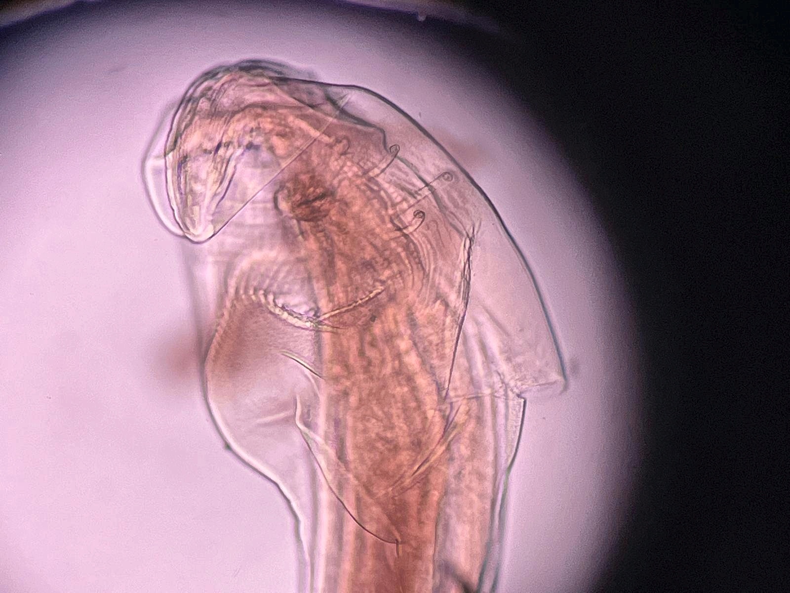Microscopic anterior view of a nematode specimen from the SEPS imaging archive