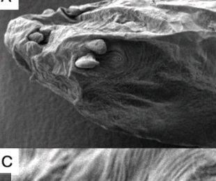 SEM overview of a pentastome anterior region