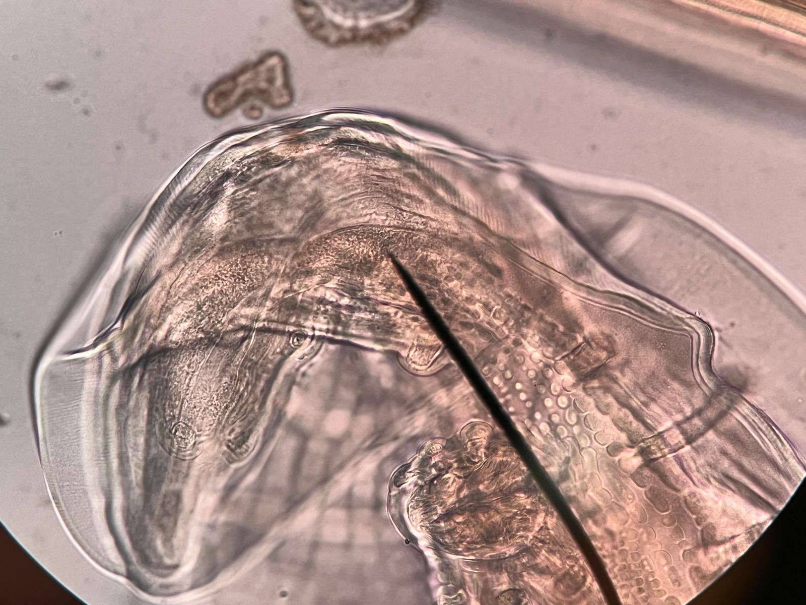 Detailed transmitted-light view of the anterior region of a nematode specimen