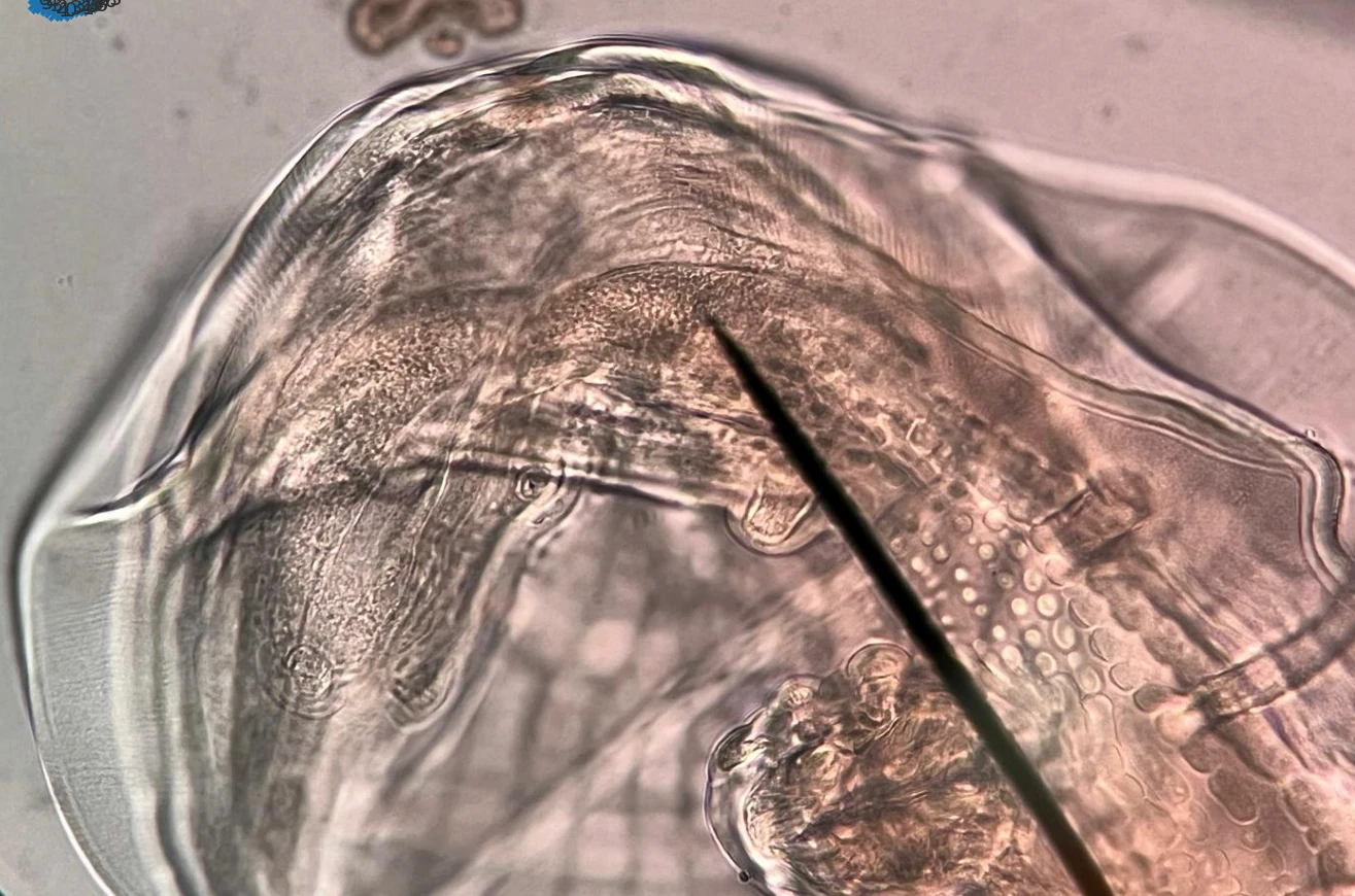 Microscope view of parasite morphology prepared for image evidence review