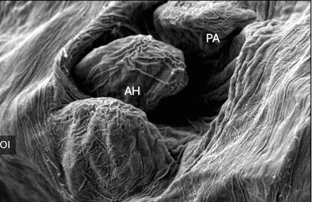 Scanning electron micrograph of parasite attachment structures