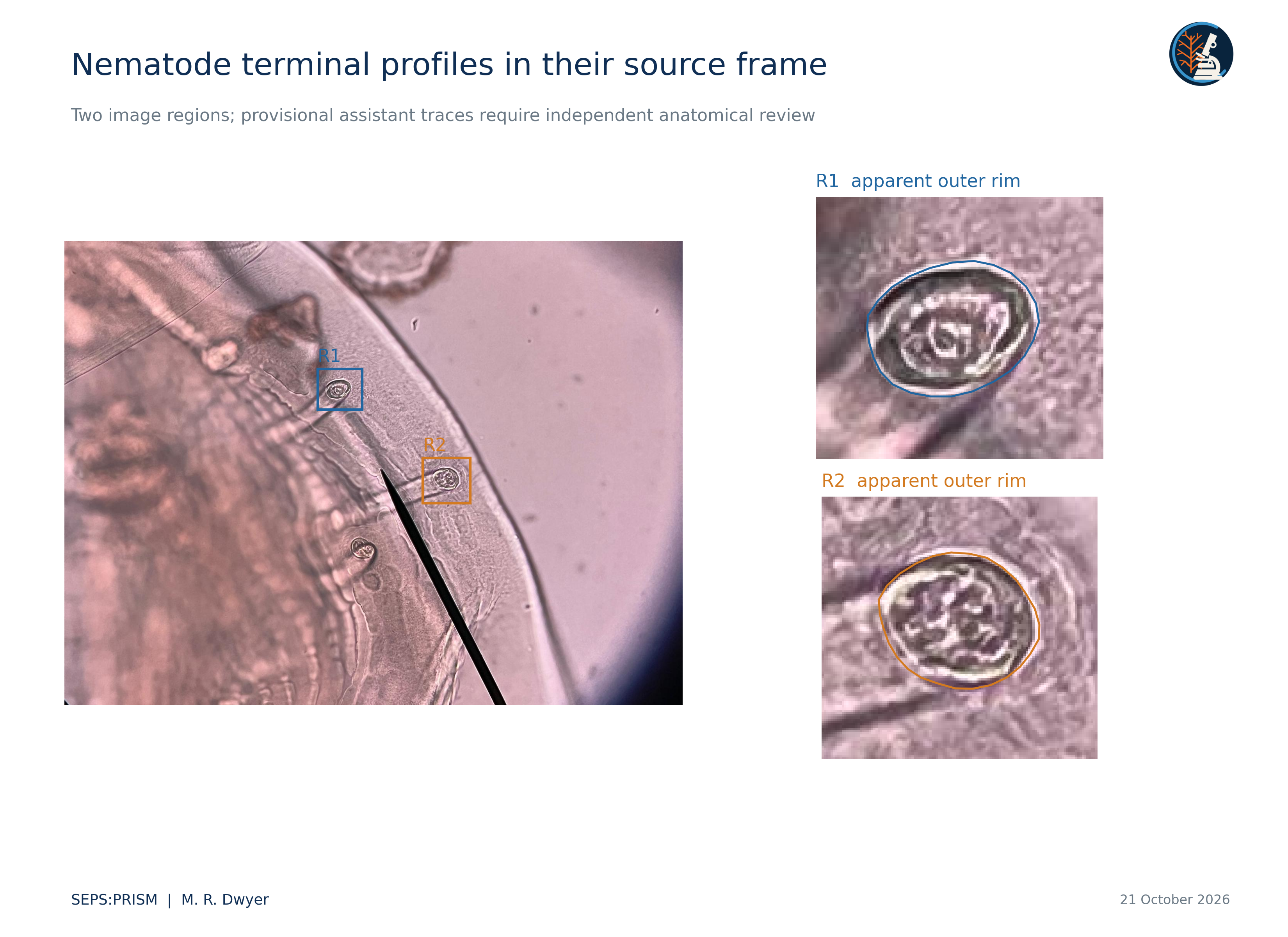 Nematode profile morphometry: accompanying scientific figure