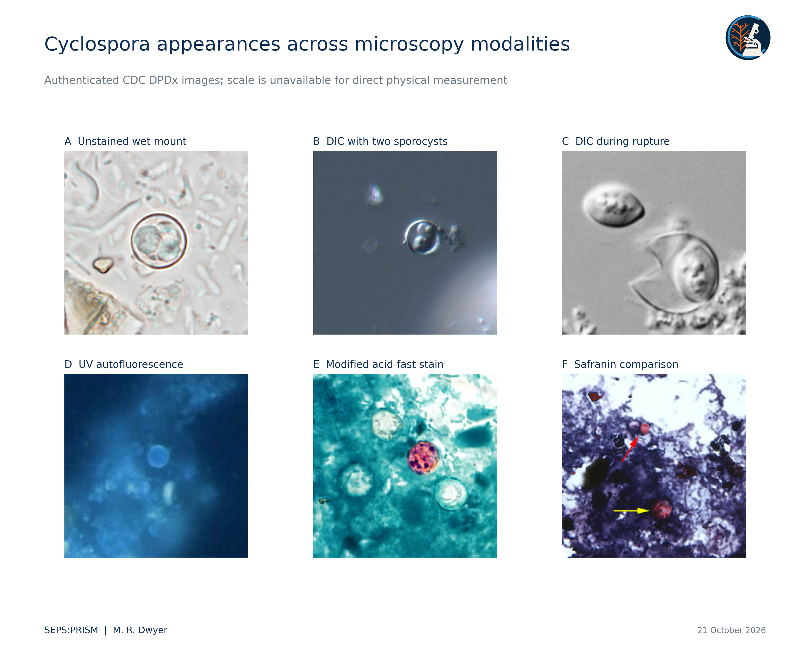 C02_CDC_Microscopy_Gallery